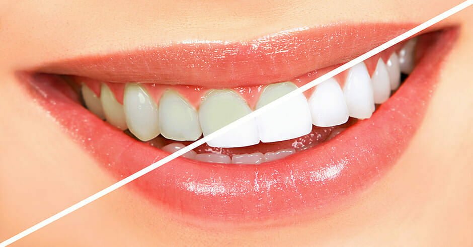 رژیم غذائی حاوی لبنیات برای داشتن دندانهای سالم ضروری است